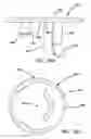 Fig. 52 - Systems and methods for tissue removal