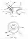 Fig. 64 - Systems and methods for tissue removal
