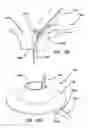 Fig. 65 - Systems and methods for tissue removal