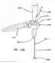 Fig. 67 - Systems and methods for tissue removal