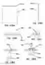 Fig. 71 - Systems and methods for tissue removal