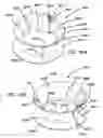 Fig. 89 - Systems and methods for tissue removal