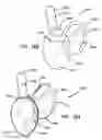 Fig. 98 - Systems and methods for tissue removal