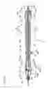 Fig. 06 - Endoscopic treatment tool