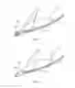 Fig. 08 - Rotational mechanical thrombectomy device