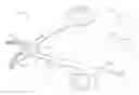 Fig. 01 - Bipolar electrosurgical hand shears