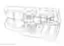 Fig. 01 - Orthodontic appliance