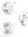Fig. 02 - METHOD OF MAKING A DENTAL PROSTHESIS