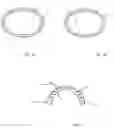 Fig. 02 - IMPLANTABLE PROSTHETIC RING FOR CORRECTING AND PREVENTING BREAST AREOLA ASYMMETRY