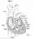 Fig. 02 - Methods of rapidly deployable surgical heart valves