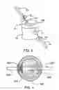 Fig. 03 - System and method for installing an annular repair rivet through a vertebral body port
