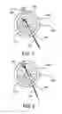 Fig. 06 - System and method for installing an annular repair rivet through a vertebral body port
