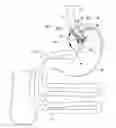 Fig. 01 - System and apparatus for adjustable gastric bypass