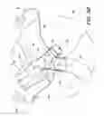 Fig. 06 - System and apparatus for adjustable gastric bypass