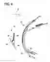 Fig. 08 - Shoulder orthosis including flexion/extension device