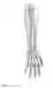 Fig. 06 - METHODS FOR INTEGRATING SENSORS AND EFFECTORS IN CUSTOM THREE-DIMENSIONAL ORTHOSIS