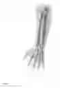 Fig. 07 - METHODS FOR INTEGRATING SENSORS AND EFFECTORS IN CUSTOM THREE-DIMENSIONAL ORTHOSIS