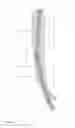 Fig. 09 - METHODS FOR INTEGRATING SENSORS AND EFFECTORS IN CUSTOM THREE-DIMENSIONAL ORTHOSIS