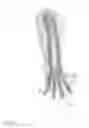 Fig. 43 - METHODS FOR INTEGRATING SENSORS AND EFFECTORS IN CUSTOM THREE-DIMENSIONAL ORTHOSIS