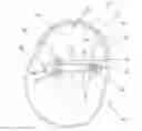 Fig. 01 - Ostomy Appliance