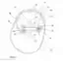 Fig. 02 - Ostomy Appliance