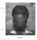 Fig. 06 - APPARATUS AND METHOD FOR COOLING HEAD INJURY