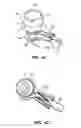 Fig. 09 - Patient interface for ophthalmologic diagnostic and interventional procedures