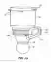 Fig. 16 - Patient interface for ophthalmologic diagnostic and interventional procedures