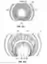 Fig. 32 - Patient interface for ophthalmologic diagnostic and interventional procedures