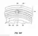 Fig. 33 - Patient interface for ophthalmologic diagnostic and interventional procedures