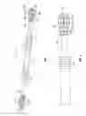 Fig. 02 - Utility device for removing earwax