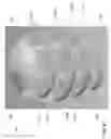 Fig. 09 - Utility device for removing earwax