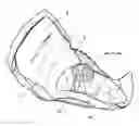 Fig. 01 - Incontinence system