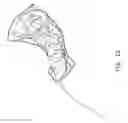 Fig. 23 - Incontinence system