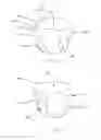 Fig. 02 - ABSORBENT ARTICLES COMPRISING SENSORS