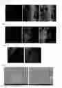 Fig. 09 - MUCOADHESIVE CARRIERS OF PARTICLES, METHOD OF PREPARATION AND USES THEREOF