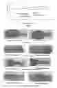 Fig. 02 - APPLICATION OF ANDROGRAPHOLIDE IN THE PREPARATION OF A PHARMACEUTICAL FOR TREATMENT OF INFLAMMATORY BOWEL DISEASE, ANDROGRAPHOLIDE ENTERIC TARGETING MICROPELLET, AND METHOD FOR PREPARATION THEREOF