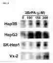 Fig. 09 - Methods and compositions for administration of 3-halopyruvate and related compounds for the treatment of cancer