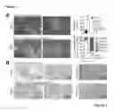 Fig. 03 - METHOD OF PRODUCING LEUKOCYTES USING PTPN2 INHIBITION FOR ADOPTIVE CELL TRANSFER