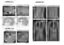 Fig. 49 - Administration of Engineered T Cells for Treatment of Cancers in the Central Nervous System