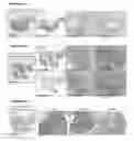 Fig. 51 - Administration of Engineered T Cells for Treatment of Cancers in the Central Nervous System