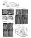 Fig. 54 - Administration of Engineered T Cells for Treatment of Cancers in the Central Nervous System