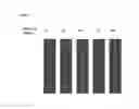 Fig. 11 - Tumor infiltrating cells engineered to express a pro-inflammatory polypeptide