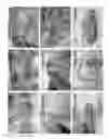 Fig. 03 - METHOD AND APPARATUS FOR RECOVERY OF UMBILICAL CORD TISSUE DERIVED REGENERATIVE CELLS AND USES THEREOF