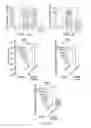 Fig. 05 - Engraftment of stem cells with a combination of an agent that targets stem cells and modulation of immunoregulatory signaling