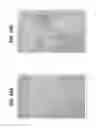 Fig. 15 - Compositions and methods for invasive and non-invasive procedural skincare