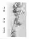 Fig. 17 - Compositions and methods for invasive and non-invasive procedural skincare