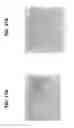 Fig. 18 - Compositions and methods for invasive and non-invasive procedural skincare