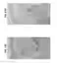 Fig. 19 - Compositions and methods for invasive and non-invasive procedural skincare