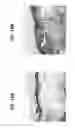 Fig. 20 - Compositions and methods for invasive and non-invasive procedural skincare